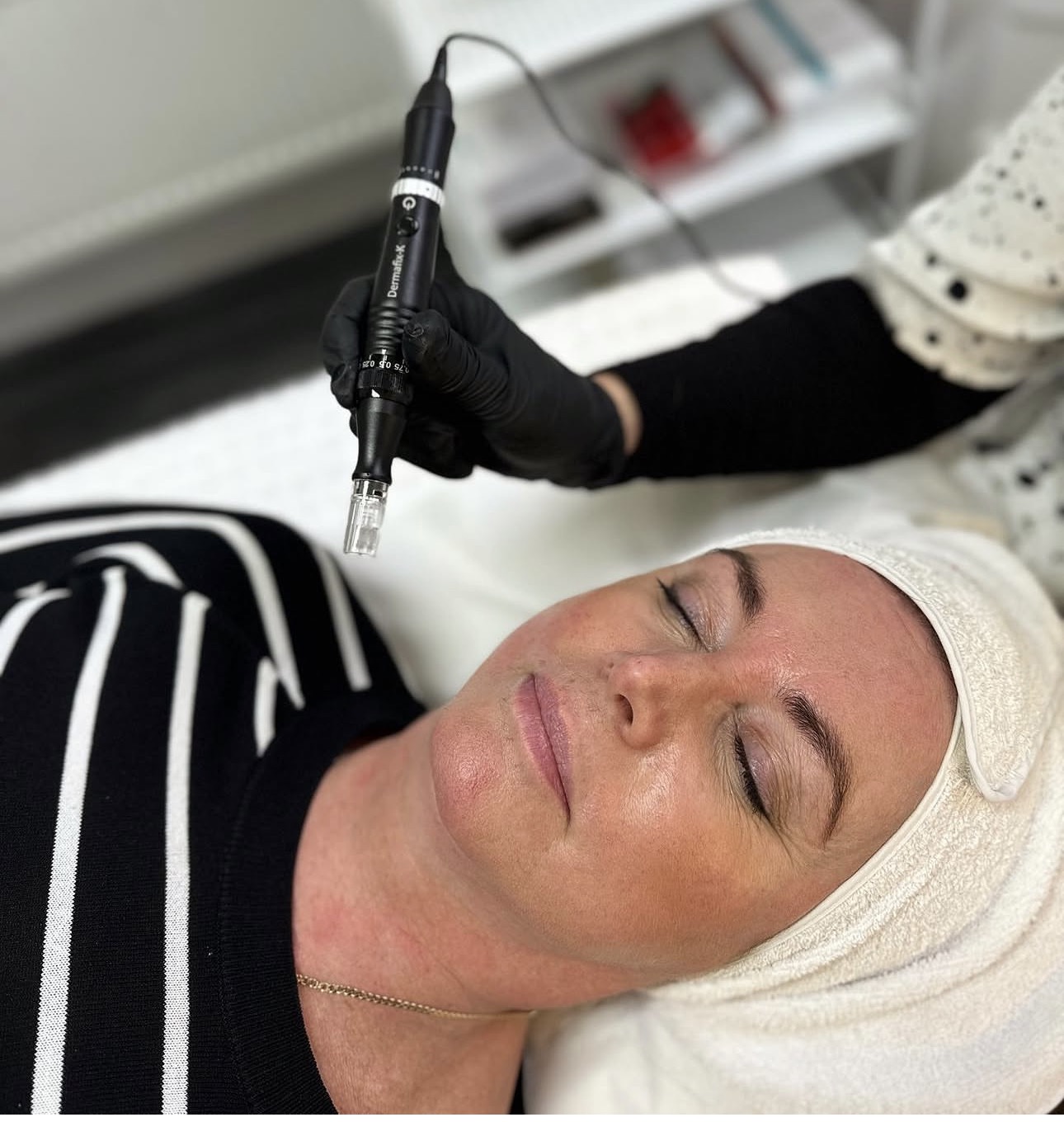 GENOSYS practitioner performing a professional in-clinic skin treatment using a microneedling device